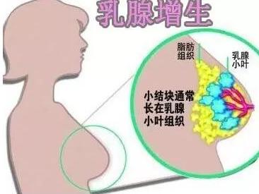 鹿角帽粉對(duì)乳腺增生有效嗎